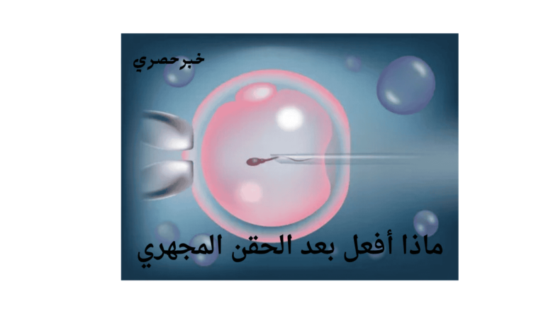 ماذا افعل بعد الحقن المجهري