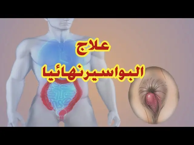 أفضل مرهم لعلاج البواسير