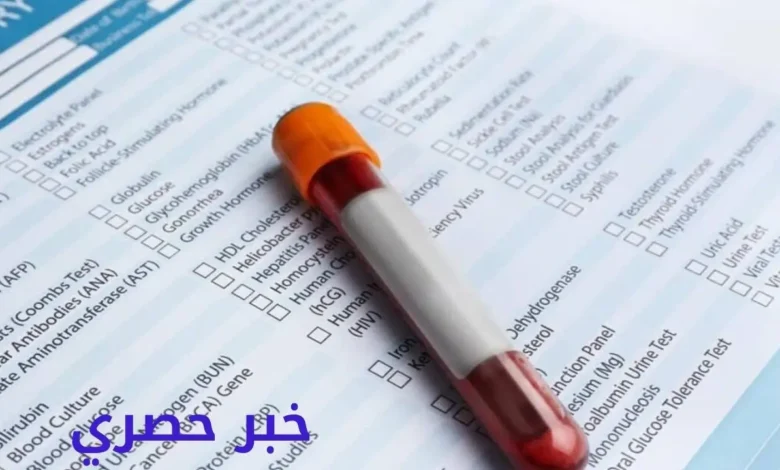 أسعار تحاليل معامل مبرة العصافرة