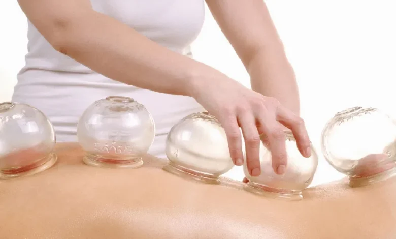 مراكز حجامة الرياض
