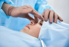 عمليات التجميل في الرياض